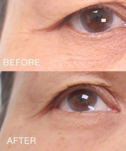 Gia công Kem xóa nhăn mắt 2 phút 7 kem mat 4 min