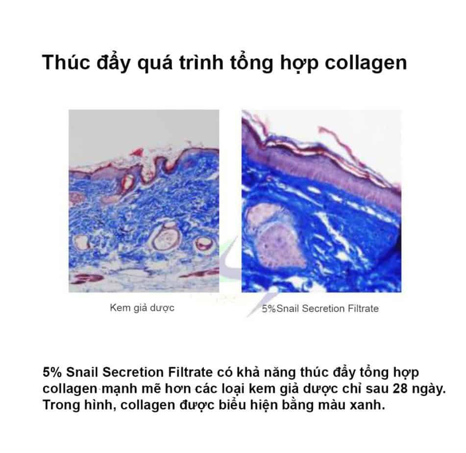 Quá trình tổng hợp collagen Quá trình tổng hợp collagen