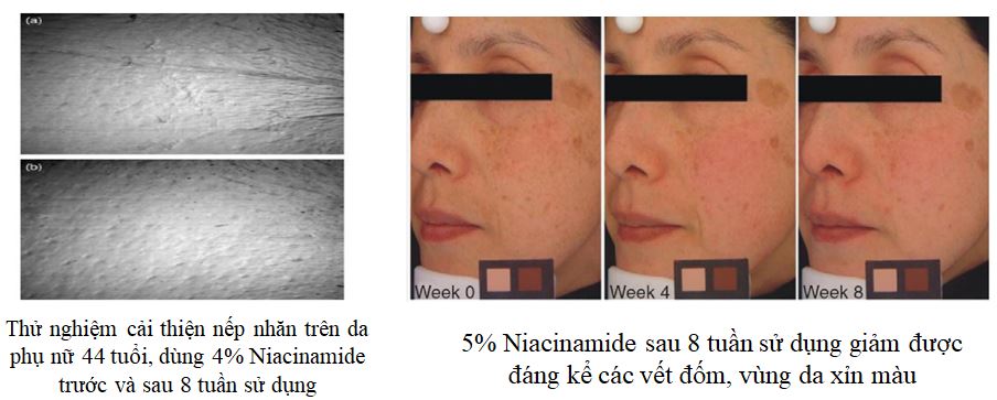 Hiệu quả cải thiện sau 2 tuần và 8 tuần khi sử dụng Kem trị nám 14 ngày cao cấp được gia công sản xuất bởi iFREE