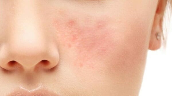 nguyên liệu hóa mỹ phẩm