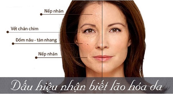 thành phần niacinamide
