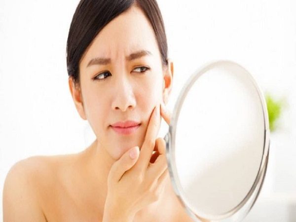 jojoba oil for acne
