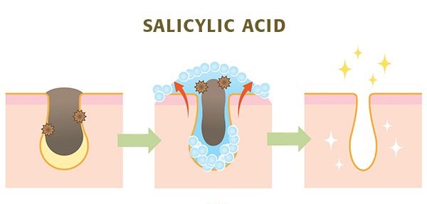 công dụng Salicylic Acid