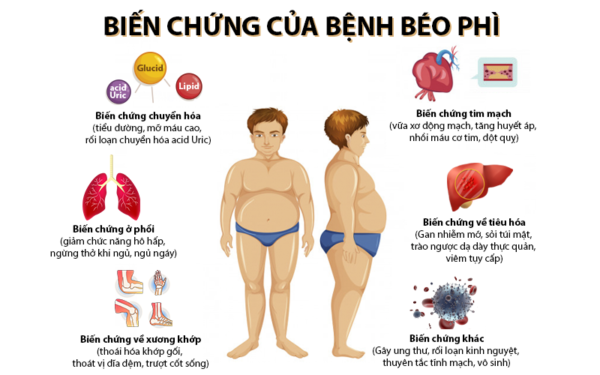 Kem tan mỡ sinh học - Đánh tan mỡ thừa 1 tác hại thừa cân béo phì