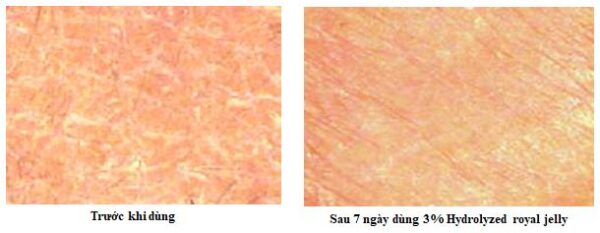 tác dụng trước sau sữa ong chúa