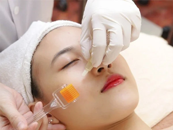 Triệu chứng sau vi kim khác lạ nhắc bạn nên tới Spa kiểm tra thật sớm 10 triệu chứng sau vi kim