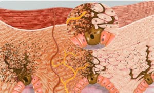 Phân loại sắc tố melanin 4 melanin 300x182 1