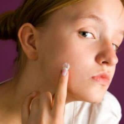 Nguyên nhân và phương pháp điều trị các loại mụn 41 sử dụng mỹ phẩm trị mụn