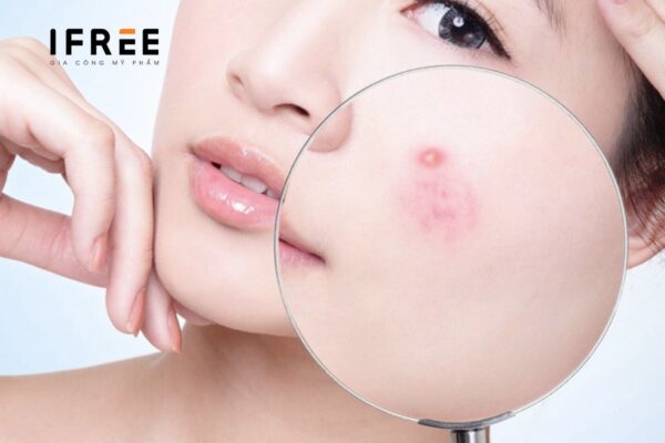 Hiểm họa mỹ phẩm nhiễm vi sinh - Tiêu chuẩn giới hạn quy định 7 mỹ phẩm nhiễm vi sinh