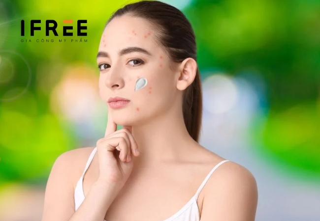 Da mụn dùng kem chống nắng - Nên hay không? 15 Da mụn dùng kem chống nắng