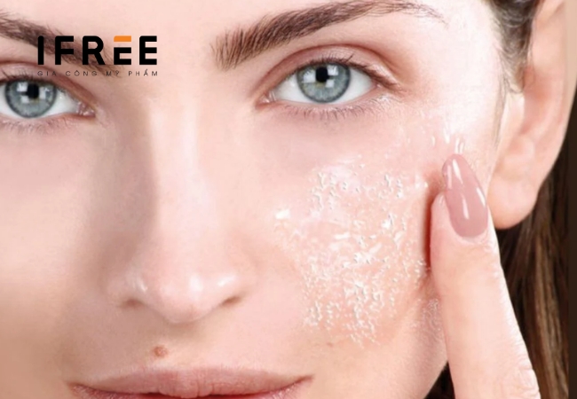 Da tăng sắc tố sau peel