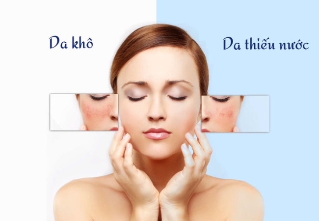 Phân biệt da thiếu nước và da khô để chăm sóc phù hợp 61 da thiếu nước
