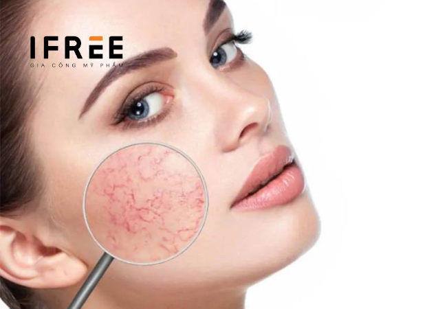 phục hồi da mỏng yếu