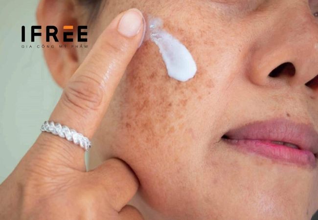 3+ thành phần nên có trong kem trị nám 12 3+ thành phần nên có trong kem trị nám