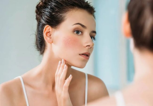 Bôi kem dưỡng ẩm bị rát mặt - Vì sao? 7 Bôi kem dưỡng ẩm bị rát mặt - Vì sao?