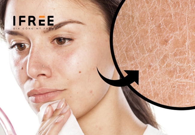 Cồn trong mỹ phẩm - Có lợi hay có hại cho da? 45 Cồn trong mỹ phẩm - Có lợi hay có hại cho da?