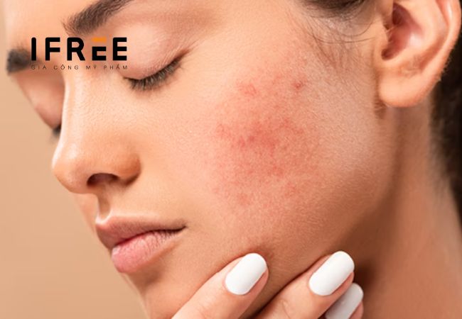 Kem dưỡng B5 mang lại lợi ích gì cho da?