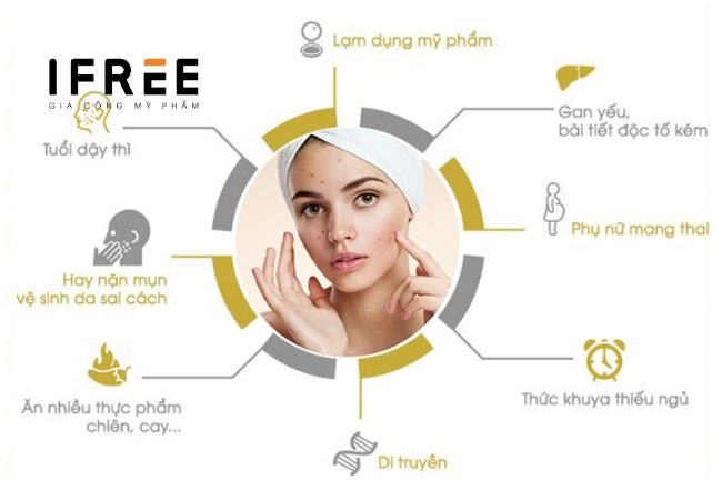 Mụn trứng cá là gì? Điều trị thế nào?