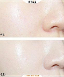 Gia công kem chống nắng quang phổ rộng 5 Gia công kem chống nắng quang phổ rộng