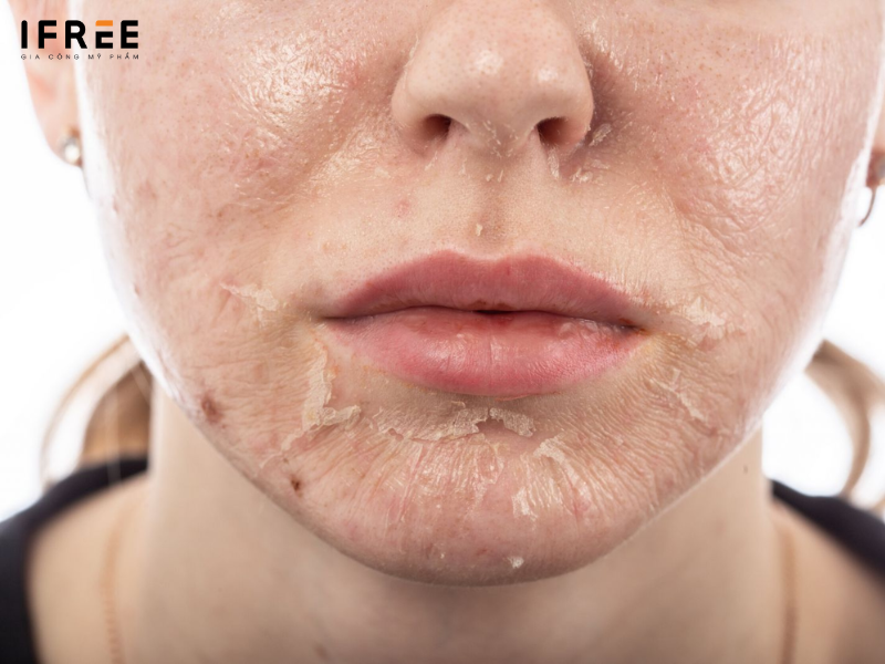 gia công sản phẩm peel da